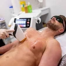 Laser Hair Removal - Full Chest